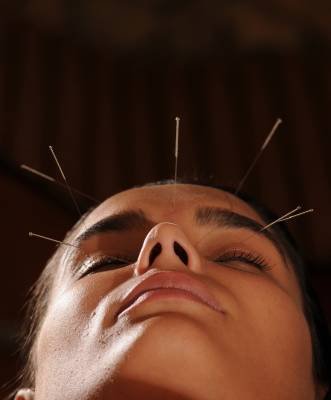 07/01/2013. Crédito: Zuleika de Souza/CB/D.A Press. Brasil. Brasília - DF. Produção acupuntura.